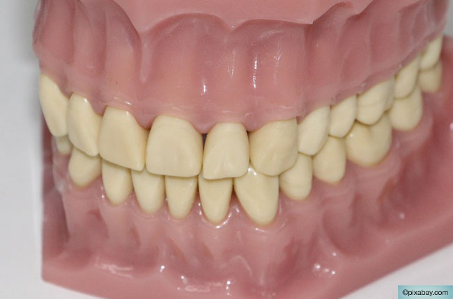 Verborgene Zahnimplantate und ihre Vor- und Nachteile